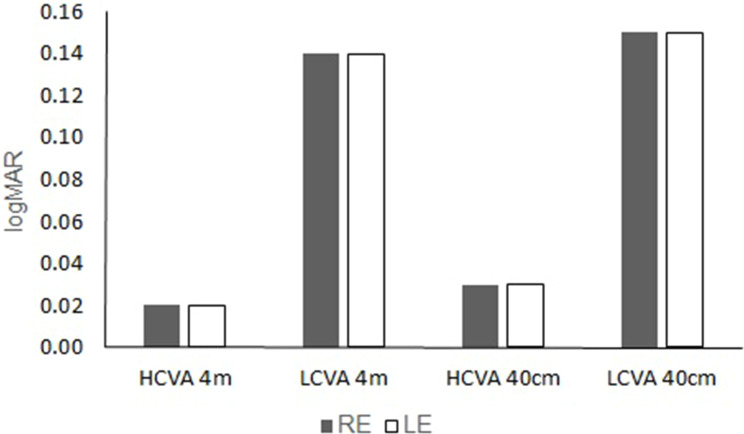 Baseline Accommodation and Binocular Vision Measures in Malay Schoolchildren Enrolled in the Myopia Control Study Using Spectacle Lenses in Kuala Lumpur.