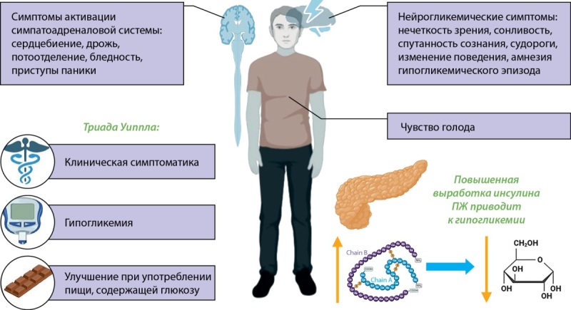 [Current views on the treatment of insulinoma].