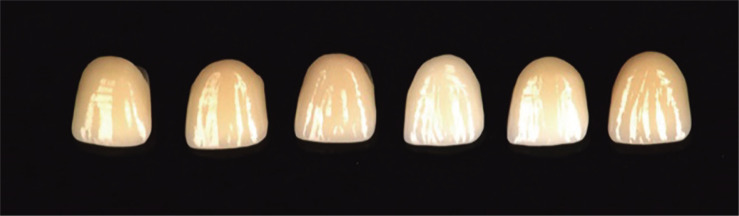 Comparison of different digital shade selection methodologies in terms of accuracy.