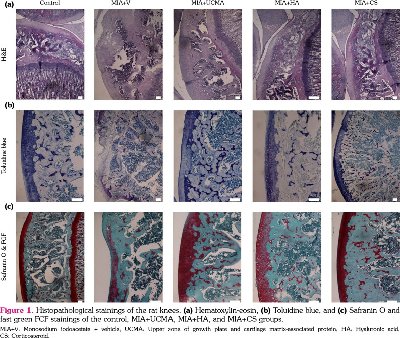 Comparison of the protective effect of the upper zone of the growth plate and unique cartilage matrix-associated protein with hyaluronic acid and corticosteroids on an experimental rat osteoarthritis model.