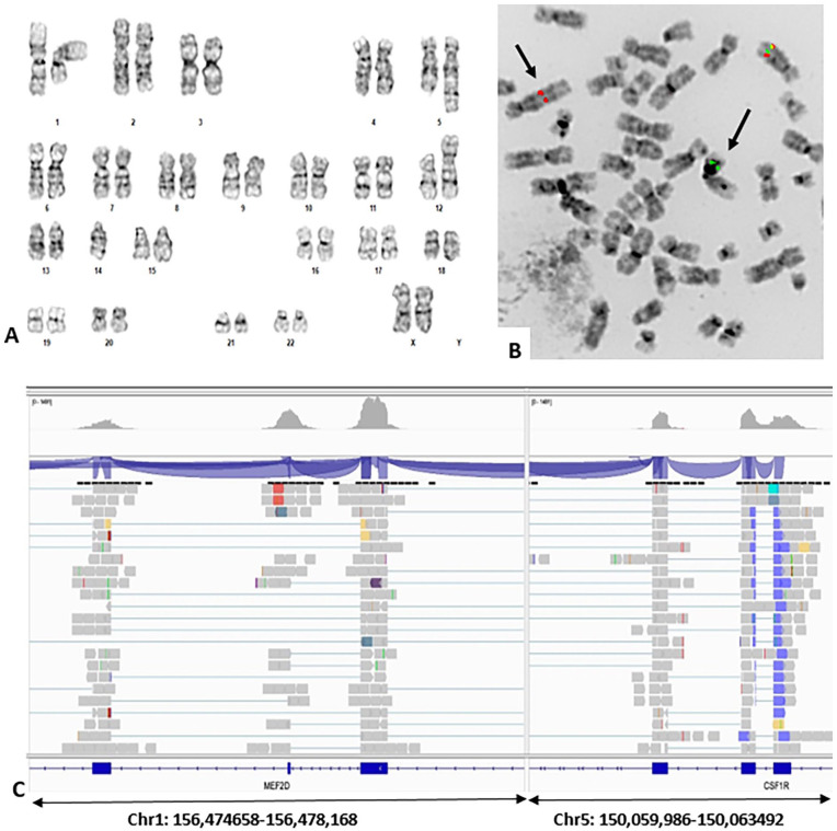 RNASeq Analysis for Accurate Identification of Fusion Partners in Tumor Specific Translocations Detected by Standard FISH Probes in Hematologic Malignancies.