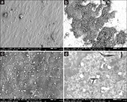 Anti-cancer effects of green synthesized gold nanoparticles using leaf extract of <i>Annona muricata</i>. L against squamous cell carcinoma cell line 15 through apoptotic pathway.