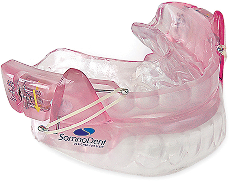 Effectiveness of Mandibular Advancement Devices in Positional OSA Patients: A Retrospective Analysis of Predictive Variables in a Sample of Adult Patients.