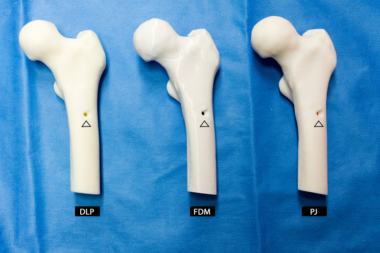 Dimensional accuracy and precision and surgeon perception of additively manufactured bone models: effect of manufacturing technology and part orientation.