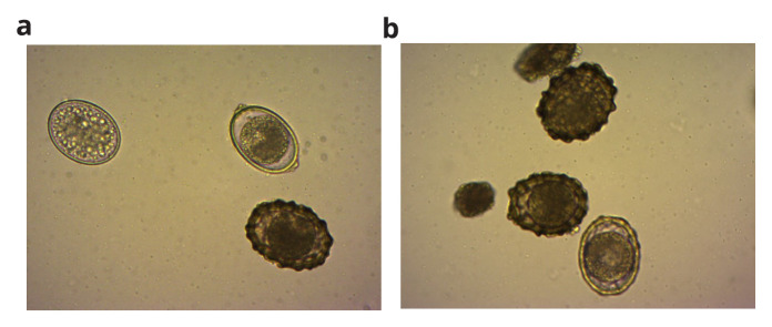 Study of helminth eggs ( <i>Ascaris suum)</i> inactivation by anaerobic digestion and electrochemical treatment.