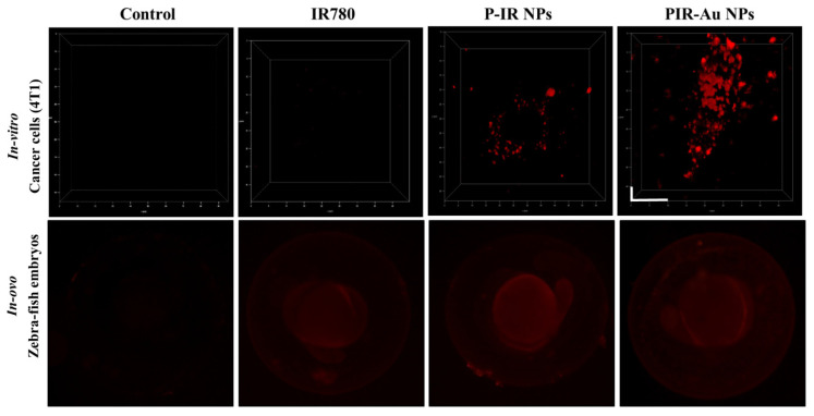 A lipo-polymeric hybrid nanosystem with metal enhanced fluorescence for targeted imaging of metastatic breast cancer.