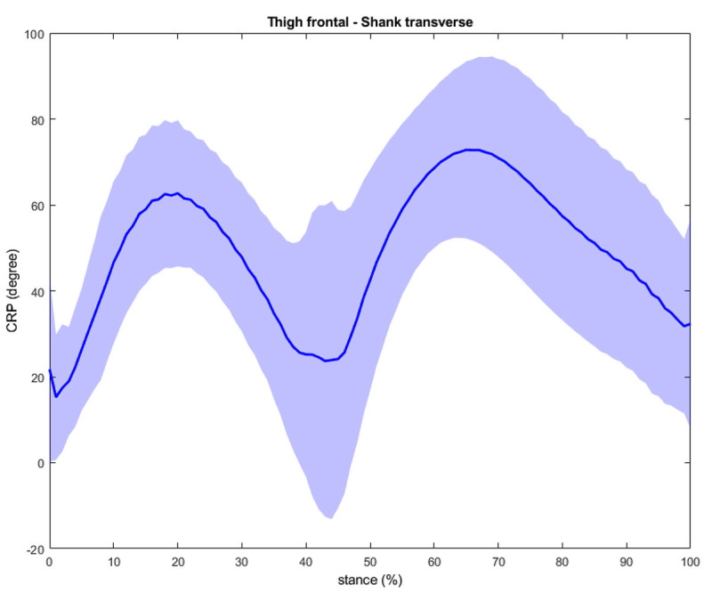 The Correlation between Intersegmental Coordination Variability and Frontal Plane Hip Kinematics during Running in Persons with Patellofemoral Pain.