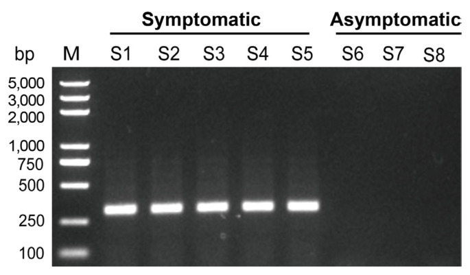 Molecular Characterization of an Isolate of Bean Common Mosaic Virus First Identified in Gardenia Using Metatranscriptome and Small RNA Sequencing.
