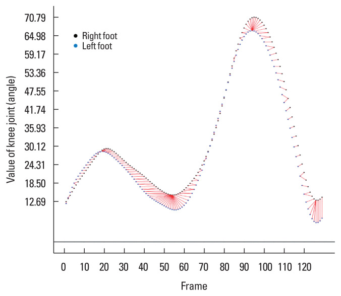 A method for selecting the optimal warping path of dynamic time warping in gait analysis.