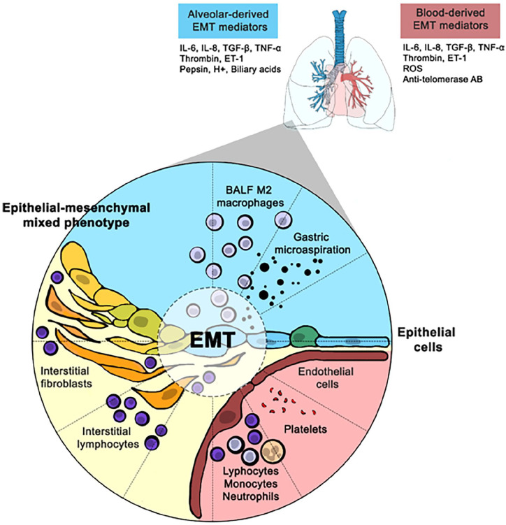 Alveolar epithelial-to-mesenchymal transition in scleroderma interstitial lung disease: Technical challenges, available evidence and therapeutic perspectives.