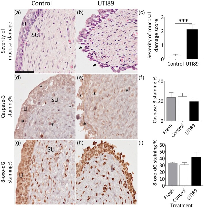 Uropathogenic Escherichia coli causes significant urothelial damage in an ex vivo porcine bladder model, with no protective effect observed from cranberry or d-mannose.