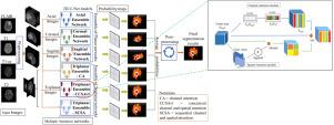 A triplanar ensemble model for brain tumor segmentation with volumetric multiparametric magnetic resonance images