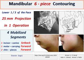 Mandibular retrusion six-piece contouring by combined anterior subapical setback, BSSO advancement, and two-step genioplasty