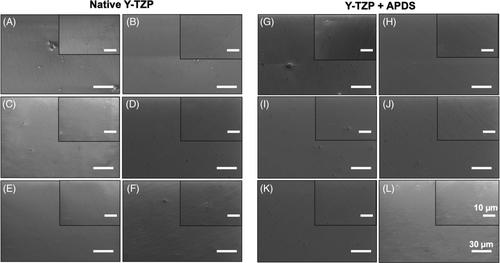 Functionalization of a zirconia surface by covalently immobilized fibronectin and its effects on resistance to thermal, acid, and mechanical exposure