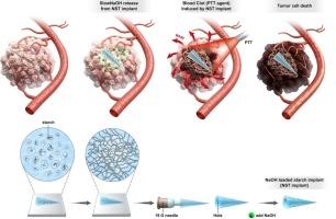 Enhancing photothermal therapy via blood clot induced by needle-type sodium hydroxide-loaded starch implant