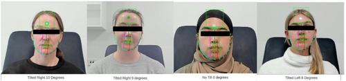 Facial and mandibular landmark tracking with habitual head posture estimation using linear and fiducial markers