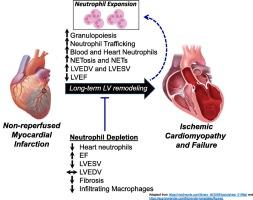 Neutrophils are indispensable for adverse cardiac remodeling in heart failure