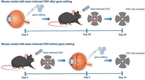 CRISPR-based gene therapy for wet age-related macular degeneration in mouse model