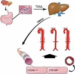 Gut microbial metabolite trimethylamine N-oxide induces aortic dissection