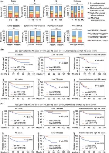 High KRT17 expression in tumour budding indicates immunologically ‘hot’ tumour budding and predicts good survival in patients with colorectal cancer