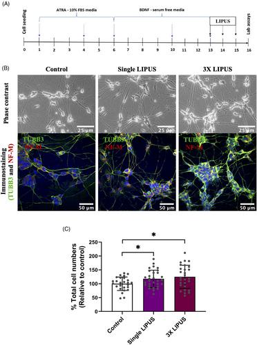 Low-intensity pulsed ultrasound induces proliferation of human neural stem cells