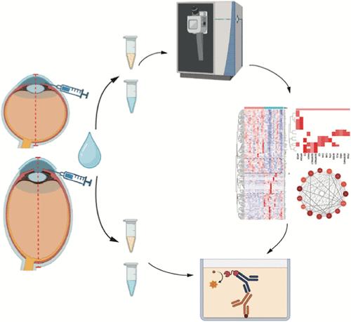 Comparative Proteomic Analysis of Aqueous Humor Reveals Biochemical Disparities in the Eyes of High Myopic Patients