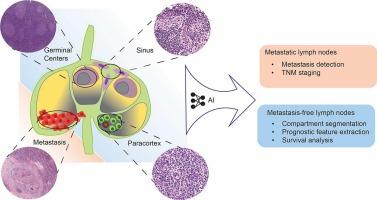 Computational methods for metastasis detection in lymph nodes and characterization of the metastasis-free lymph node microarchitecture: A systematic-narrative hybrid review