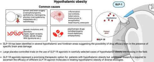 Evaluating the effectiveness and underlying mechanisms of incretin-based treatments for hypothalamic obesity: A narrative review