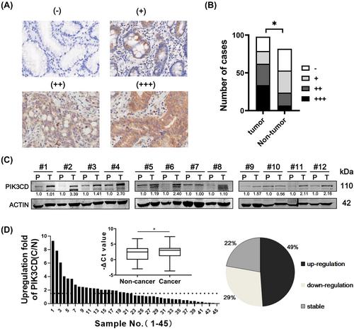 JAK3/STAT5 signaling-triggered upregulation of PIK3CD contributes to gastric carcinoma development