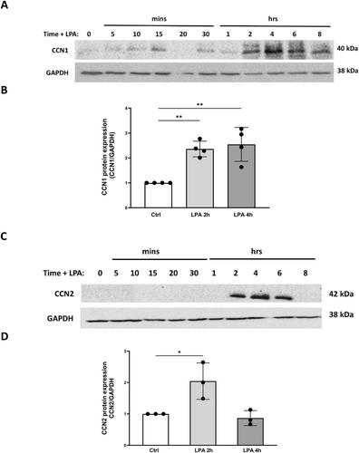 Role for CCN1 in lysophosphatidic acid response in PC-3 human prostate cancer cells