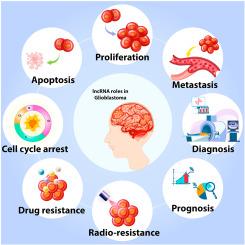 Shedding light on function of long non-coding RNAs (lncRNAs) in glioblastoma