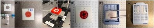 Time-resolved fluorescence and diffuse reflectance for lung squamous carcinoma margin detection