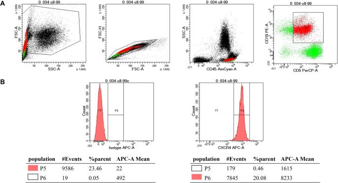 CXCR4 overexpression in chronic lymphocytic leukemia associates with poorer prognosis: A prospective, single-center, observational study