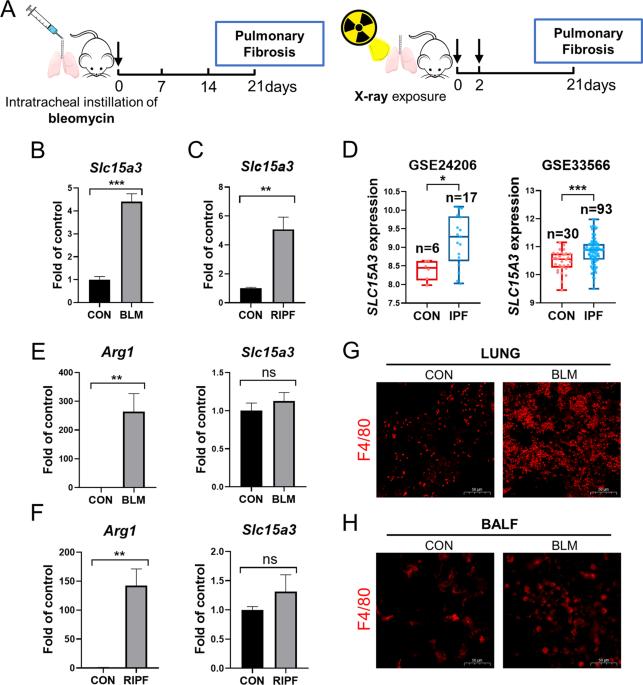 SLC15A3 plays a crucial role in pulmonary fibrosis by regulating macrophage oxidative stress