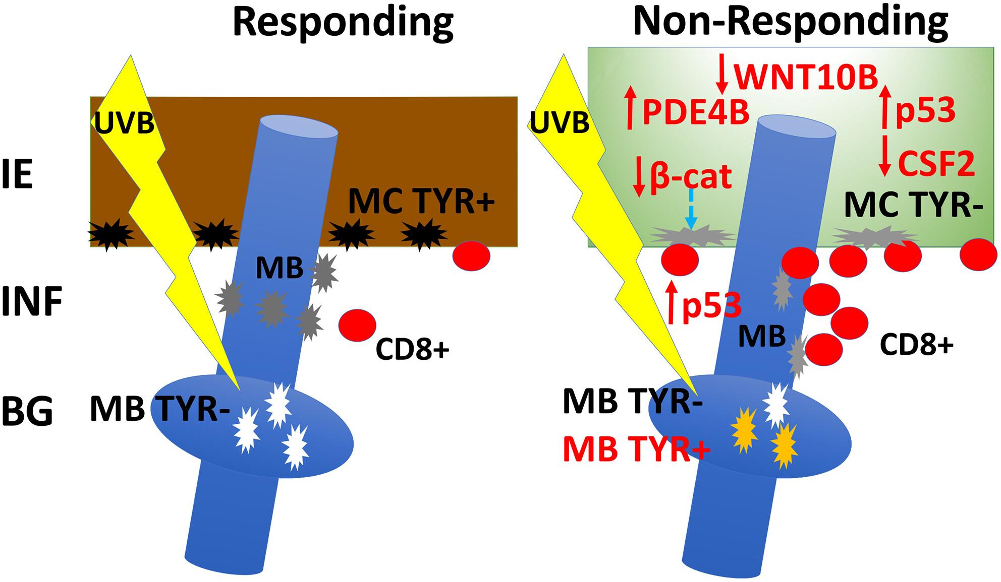 Vitiligo non-responding lesions to narrow band UVB have intriguing cellular and molecular abnormalities that may prevent epidermal repigmentation