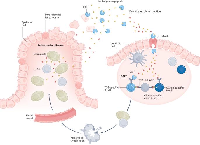 Tolerance-inducing therapies in coeliac disease — mechanisms, progress and future directions