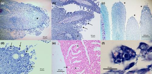 Identification of new amoebae strains in rainbow trout (Oncorhynchus mykiss, Walbaum) farms affected by nodular gill disease (NGD) in Northeastern Italy