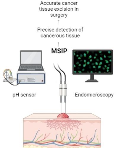 A Multimodal Bio-Sensing and Imaging Platform (MSIP) for Real-Time Intraoperative Margin Detection in Cancer Surgery