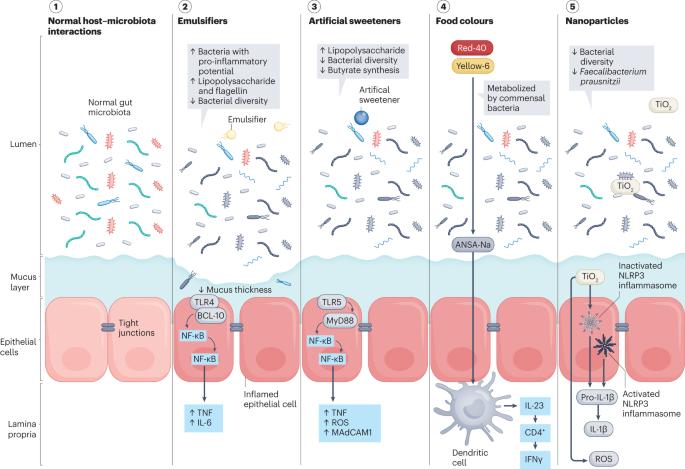 Ultra-processed foods and food additives in gut health and disease