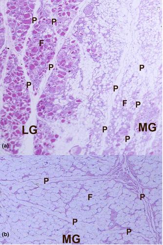 Fatty infiltration of gastrocnemius–soleus muscle complex: Considerations for myosteatosis rehabilitation