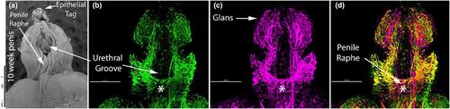 Neurovascular anatomy of the developing human fetal penis and clitoris