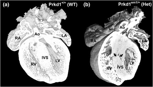 Effect of deletion of the protein kinase PRKD1 on development of the mouse embryonic heart