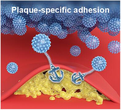 Plaque-Specific Adhesive Balloons Coated with Calcium Phosphate Nanoparticles Loaded with Rapamycin for Atherosclerosis Therapy