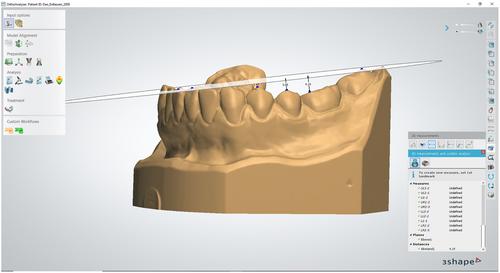 Long-term stability of curve of Spee depth among orthodontically treated patients: A retrospective longitudinal study