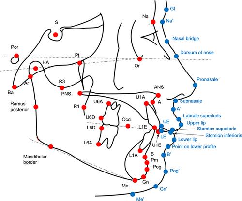 Accuracy of artificial intelligence-assisted growth prediction in skeletal Class I preadolescent patients using serial lateral cephalograms for a 2-year growth interval