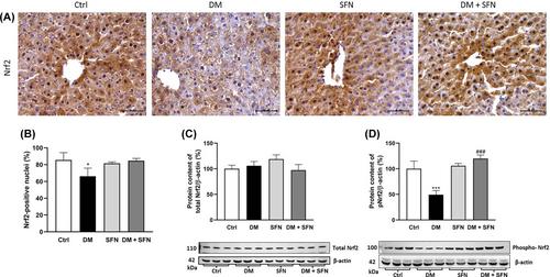 Sulforaphane prevents diabetes-induced hepatic ferroptosis by activating Nrf2 signaling axis