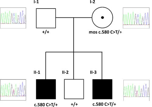 Low-grade parental gonosomal mosaicism in CHD2 siblings with Smith–Magenis-like syndrome