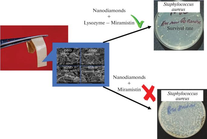 Preparation of Nanodiamond–Lysozyme–Miramistin Composite and Prospects of Its Application in Heart Valve Prosthetics