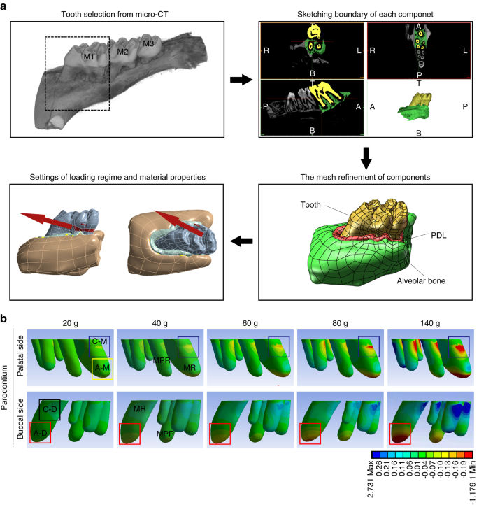 The osteoclastic activity in apical distal region of molar mesial roots affects orthodontic tooth movement and root resorption in rats.