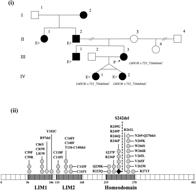 A deletion variant in LMX1B causing nail-patella syndrome in Japanese twins.